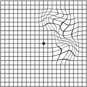 решетка Амслера скачать