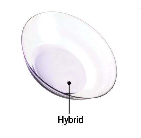 гибридные контактные линзы при астигматизме