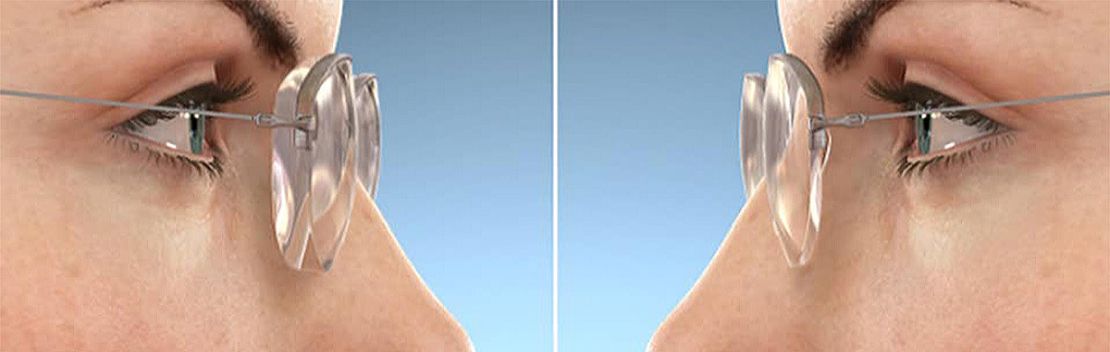 сферические линзы