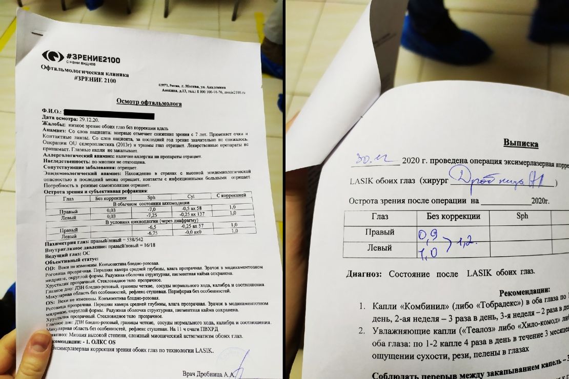 близорукость это минус