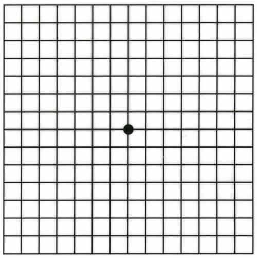 Сетка Амслера онлайн